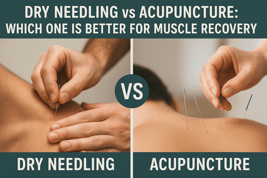 Dry Needling vs Acupuncture: Which One is Better for Muscle Recovery?